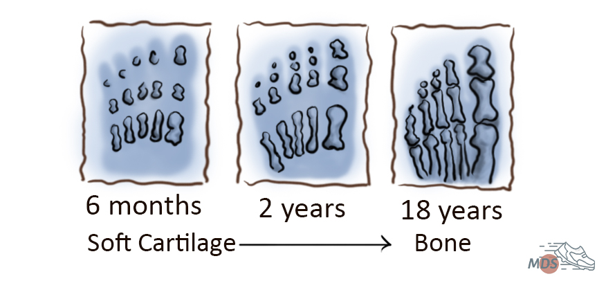 Foot-size-growth-in-children