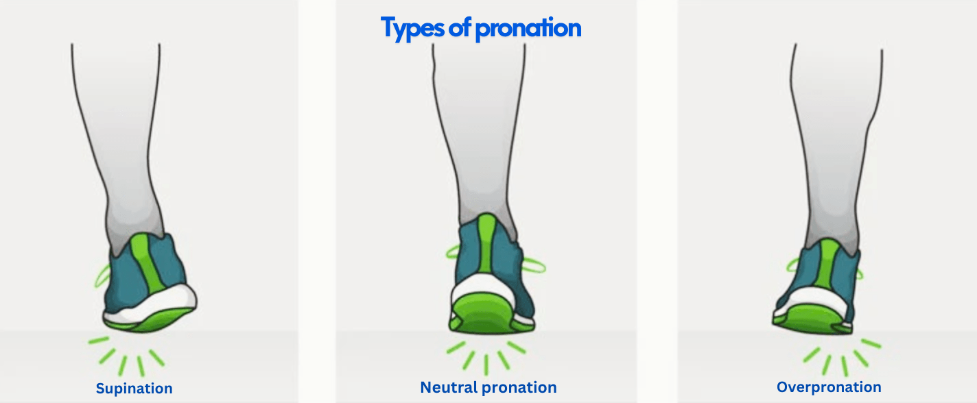 Types-of-pronation